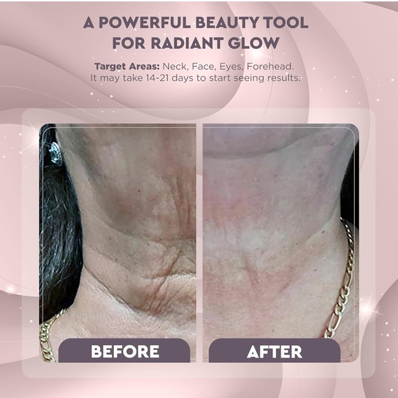 GLO24K Neck & Face Massager new open box ￼ - Picture 5 of 6